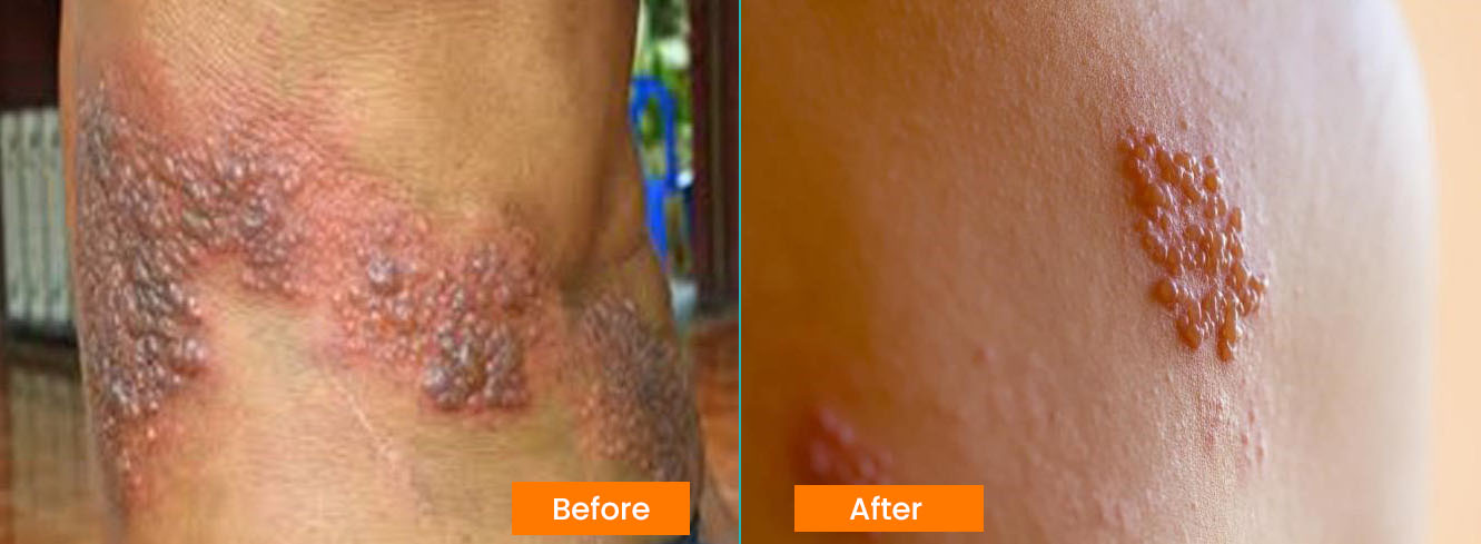 https://www.healthholistic.com/wp-content/uploads/2023/09/before-image-and-After-Image-Merge.jpg
